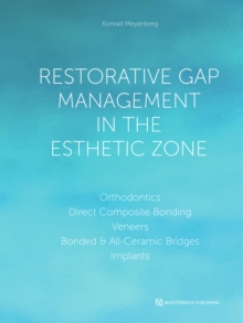 Restorative Gap Management in the Esthetic Zone : Orthodontics | Direct Composite Bonding | Veneers | Bonded & All-Ceramic Bridges | Implants