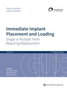 Immediate Implant Placement and Loading - Single or Multiple Teeth Requiring Replacement