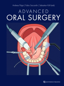 Advanced Oral Surgery