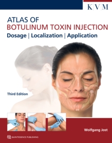 Atlas of Botulinum Toxin Injection : Dosage | Localization | Application