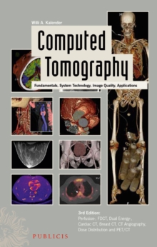 Computed Tomography : Fundamentals, System Technology, Image Quality, Applications