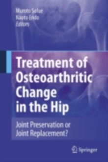 Treatment of Osteoarthritic Change in the Hip : Joint Preservation or Joint Replacement?