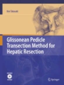 Glissonean Pedicle Transection Method for Hepatic Resection