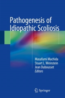 Pathogenesis of Idiopathic Scoliosis, Hardback Book Pathogenesis of Idiopathic Scoliosis, Hardback Book