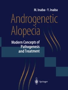 Androgenetic Alopecia : Modern Concepts of Pathogenesis and Treatment