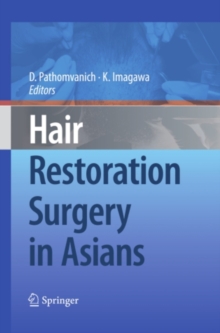 Hair Restoration Surgery in Asians