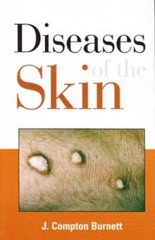 Diseases of the Skin : Their Constitutional Nature & Homeopathic Cure, Paperback / softback Book Diseases of the Skin : Their Constitutional Nature & Homeopathic Cure, Paperback / softback Book