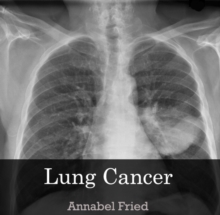 Lung Cancer