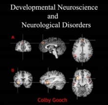 Developmental Neuroscience and Neurological Disorders