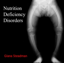 Nutrition Deficiency Disorders