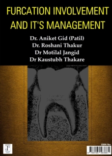 Furcation Involvement and It's Management