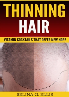 Thinning Hair : Vitamin Cocktails That Offer New Hope