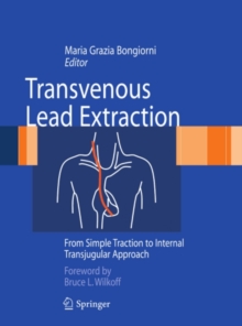 Transvenous Lead Extraction : From Simple Traction to Internal Transjugular Approach