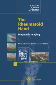 The Rheumatoid Hand : Diagnostic Imaging