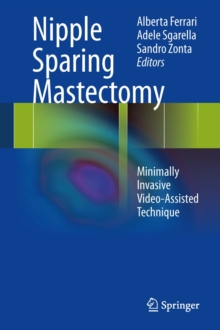 Nipple Sparing Mastectomy : Minimally Invasive Video-Assisted Technique