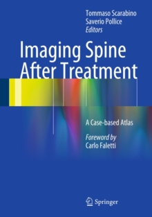 Imaging Spine After Treatment : A Case-based Atlas