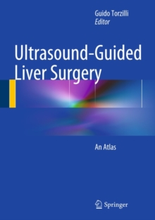 Ultrasound-Guided Liver Surgery : An Atlas