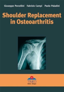 Shoulder Replacement in Osteoarthritis, Hardback Book Shoulder Replacement in Osteoarthritis, Hardback Book