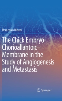 The Chick Embryo Chorioallantoic Membrane in the Study of Angiogenesis and Metastasis : The CAM assay in the study of angiogenesis and metastasis