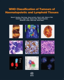 WHO classification of tumours of haematopoietic and lymphoid tissues : Vol. 2