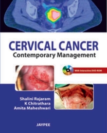 Cervical Cancer : Contemporary Management, Paperback Book Cervical Cancer : Contemporary Management, Paperback Book