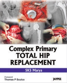 Complex Primary Total Hip Replacement, Hardback Book Complex Primary Total Hip Replacement, Hardback Book
