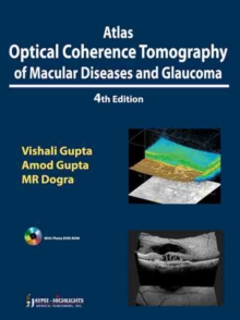 Atlas Optical Coherence Tomography of Macular Diseases and Glaucoma, Mixed media product Book Atlas Optical Coherence Tomography of Macular Diseases and Glaucoma, Mixed media product Book