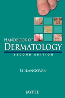 Handbook of Dermatology, Paperback / softback Book Handbook of Dermatology, Paperback / softback Book