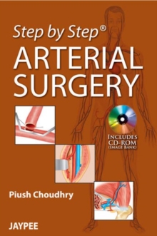 Step by Step: Arterial Surgery, Paperback / softback Book Step by Step: Arterial Surgery, Paperback / softback Book