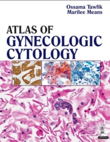 Atlas of Gynecologic Cytology, Hardback Book Atlas of Gynecologic Cytology, Hardback Book