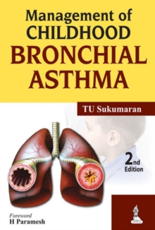 Management of Childhood Bronchial Asthma, Paperback / softback Book Management of Childhood Bronchial Asthma, Paperback / softback Book