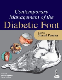 Contemporary Management of the Diabetic Foot, Paperback / softback Book Contemporary Management of the Diabetic Foot, Paperback / softback Book
