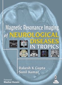 Magnetic Resonance Imaging of Neurological Diseases in Tropics, Hardback Book Magnetic Resonance Imaging of Neurological Diseases in Tropics, Hardback Book