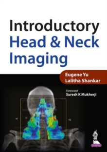 Introductory Head & Neck Imaging, Paperback / softback Book Introductory Head & Neck Imaging, Paperback / softback Book