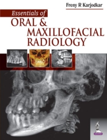 Essentials of Oral and Maxillofacial Radiology, Paperback / softback Book Essentials of Oral and Maxillofacial Radiology, Paperback / softback Book