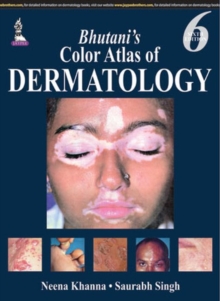 Bhutani's Color Atlas of Dermatology, Hardback Book Bhutani's Color Atlas of Dermatology, Hardback Book