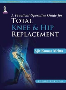 A Practical Operative Guide for Total Knee and Hip Replacement, Hardback Book A Practical Operative Guide for Total Knee and Hip Replacement, Hardback Book