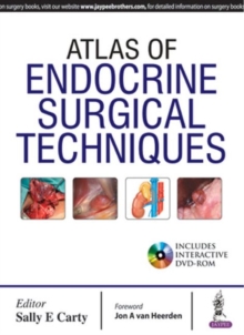 Atlas of Endocrine Surgical Techniques, Hardback Book Atlas of Endocrine Surgical Techniques, Hardback Book