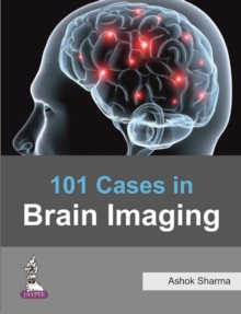 101 Cases in Brain Imaging, Paperback Book 101 Cases in Brain Imaging, Paperback Book