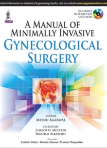 A Manual of Minimally Invasive Gynecological Surgery, Paperback / softback Book A Manual of Minimally Invasive Gynecological Surgery, Paperback / softback Book