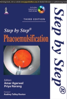 Step by Step Phacoemulsification, Paperback / softback Book Step by Step Phacoemulsification, Paperback / softback Book
