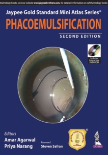 Jaypee Gold Standard Mini Atlas Series: Phacoemulsification, Paperback / softback Book Jaypee Gold Standard Mini Atlas Series: Phacoemulsification, Paperback / softback Book