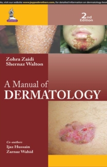 A Manual of Dermatology, Paperback Book A Manual of Dermatology, Paperback Book
