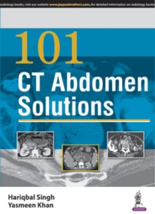101 CT Abdomen Solutions, Paperback / softback Book 101 CT Abdomen Solutions, Paperback / softback Book