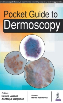 Pocket Guide to Dermoscopy, Paperback / softback Book Pocket Guide to Dermoscopy, Paperback / softback Book