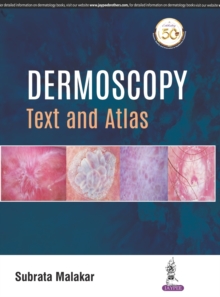 Dermoscopy : Text and Atlas, Hardback Book Dermoscopy : Text and Atlas, Hardback Book