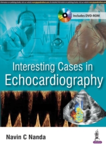 Interesting Cases in Echocardiography, Paperback / softback Book Interesting Cases in Echocardiography, Paperback / softback Book