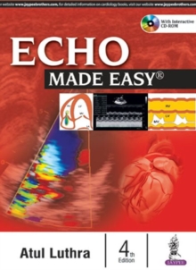 Echo Made Easy, Paperback / softback Book Echo Made Easy, Paperback / softback Book