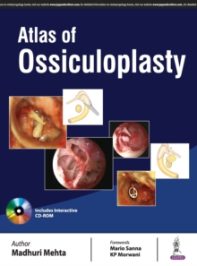 Atlas of Ossiculoplasty, Hardback Book Atlas of Ossiculoplasty, Hardback Book