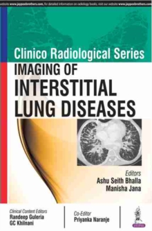 Clinico Radiological Series: Imaging of Interstitial Lung Diseases, Paperback / softback Book Clinico Radiological Series: Imaging of Interstitial Lung Diseases, Paperback / softback Book